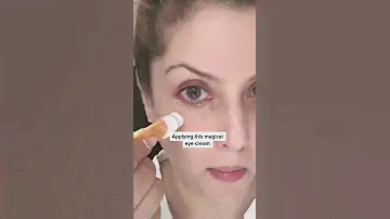 RONKIE Eye Cream|eye cream for dark circle|eye cream